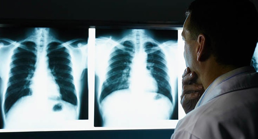 Occupational respiratory diseases